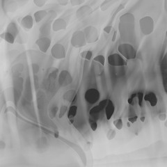 Neural Infusion [Set Mix] by 0-Dimensional