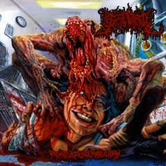 Facial Fracture - Putrid Maggot Infestation