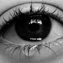 Right Eye