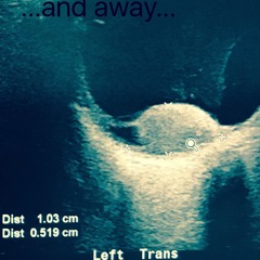 AND AWAY... (MFG MIX)