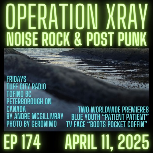 Operation XRAY EP 174 - April 11, 2025