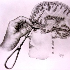 Hypnosis