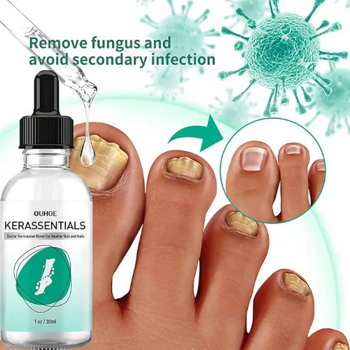 Kerassentials : Beware User’s (Price 2025) Is It Really Work Or Not?