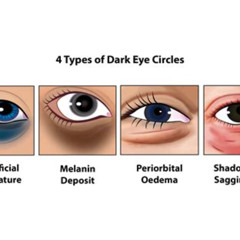 Best Under Eye Circles Treatment Reviews
