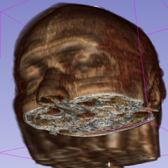 MRI Istory No Mistory MASTER