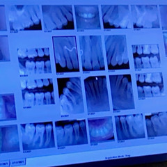 snaggle tooth [p. king theta]