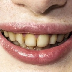 ГнилыеЗубы.xz