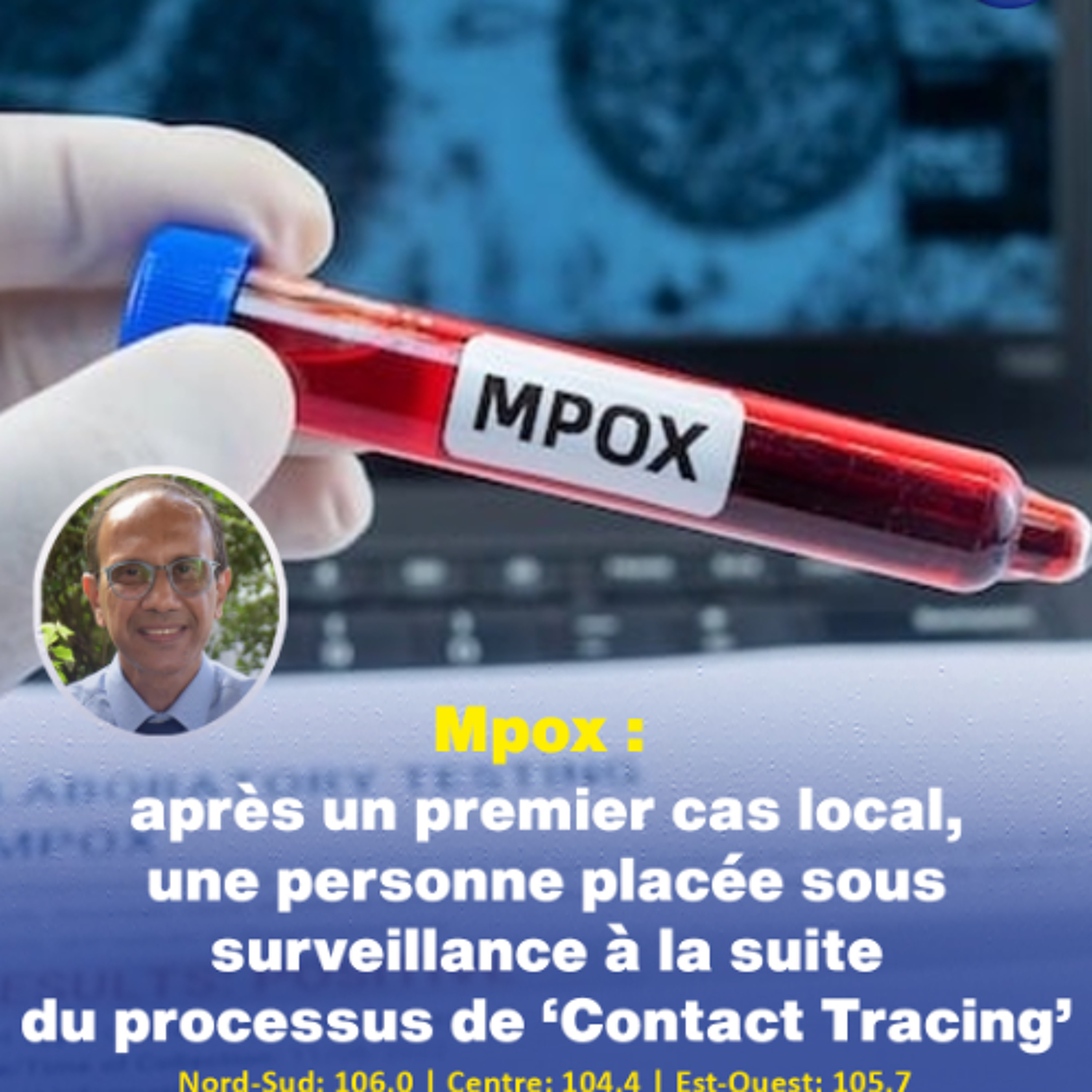 Mpox : après un premier cas local, une personne placée sous surveillance à la suite du processus de ‘Contact Tracing’