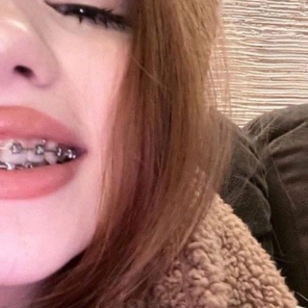 Девушка с брекетами показывает круглую попку Девушка с брекетами показывает круглую попку