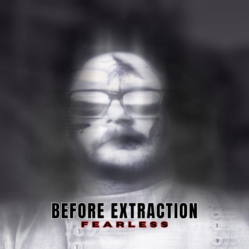 Before Extraction