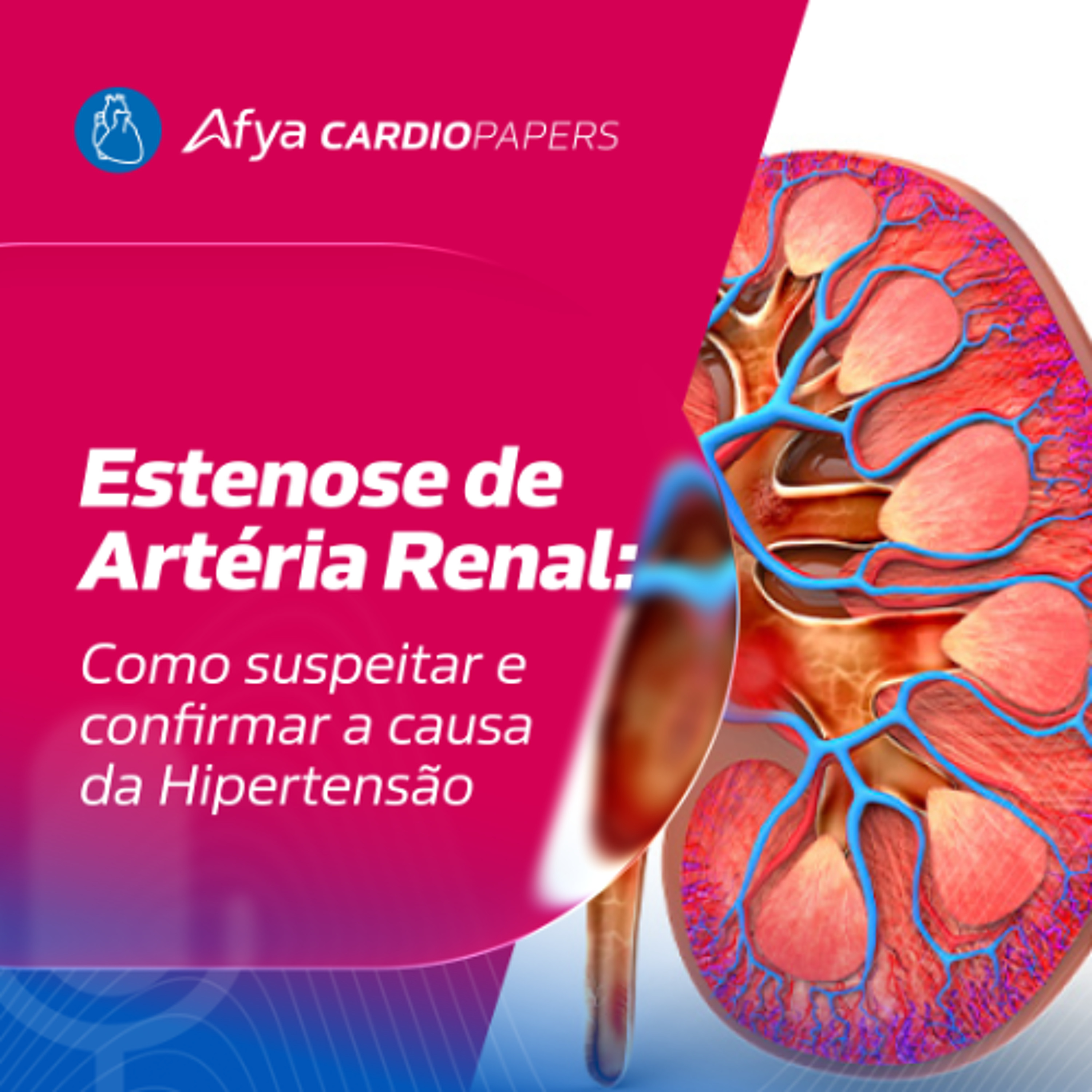 Rim x Pressão Alta: Estenose de Artéria Renal