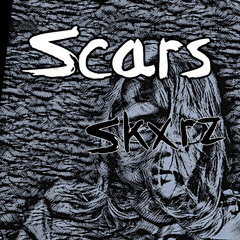 Scars prod control