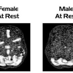 EP 346 Hjärnscanning och dr Amen