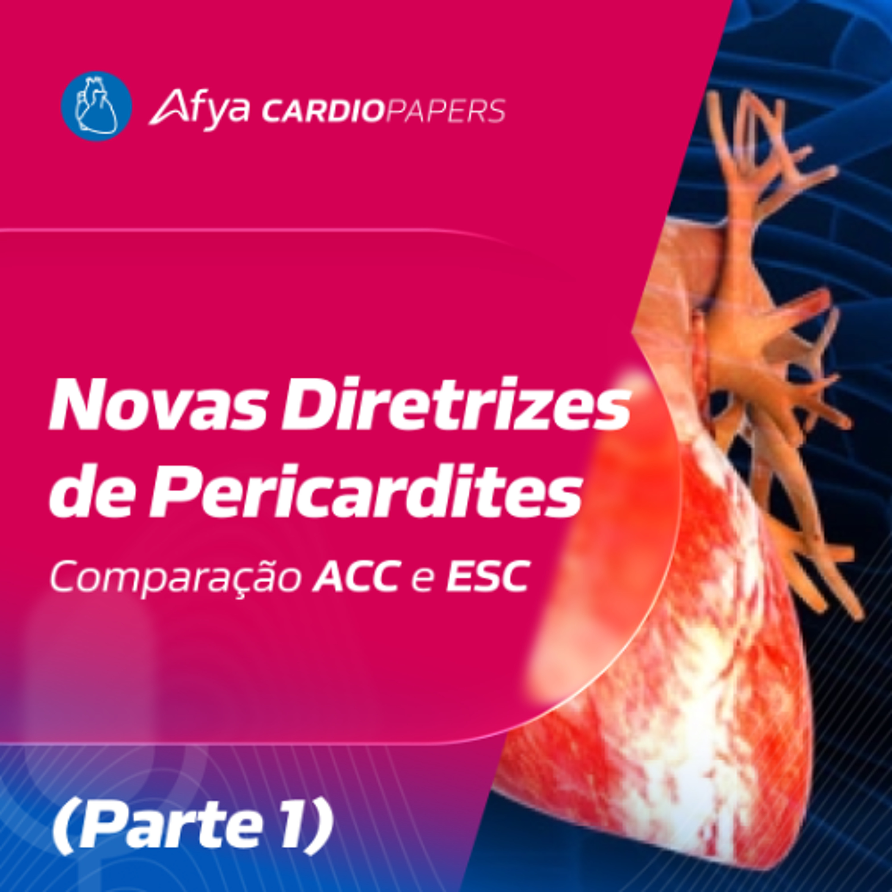 Novas diretrizes de pericardites- comparação ACC e ESC (Parte 1)