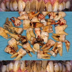 teeth🦷