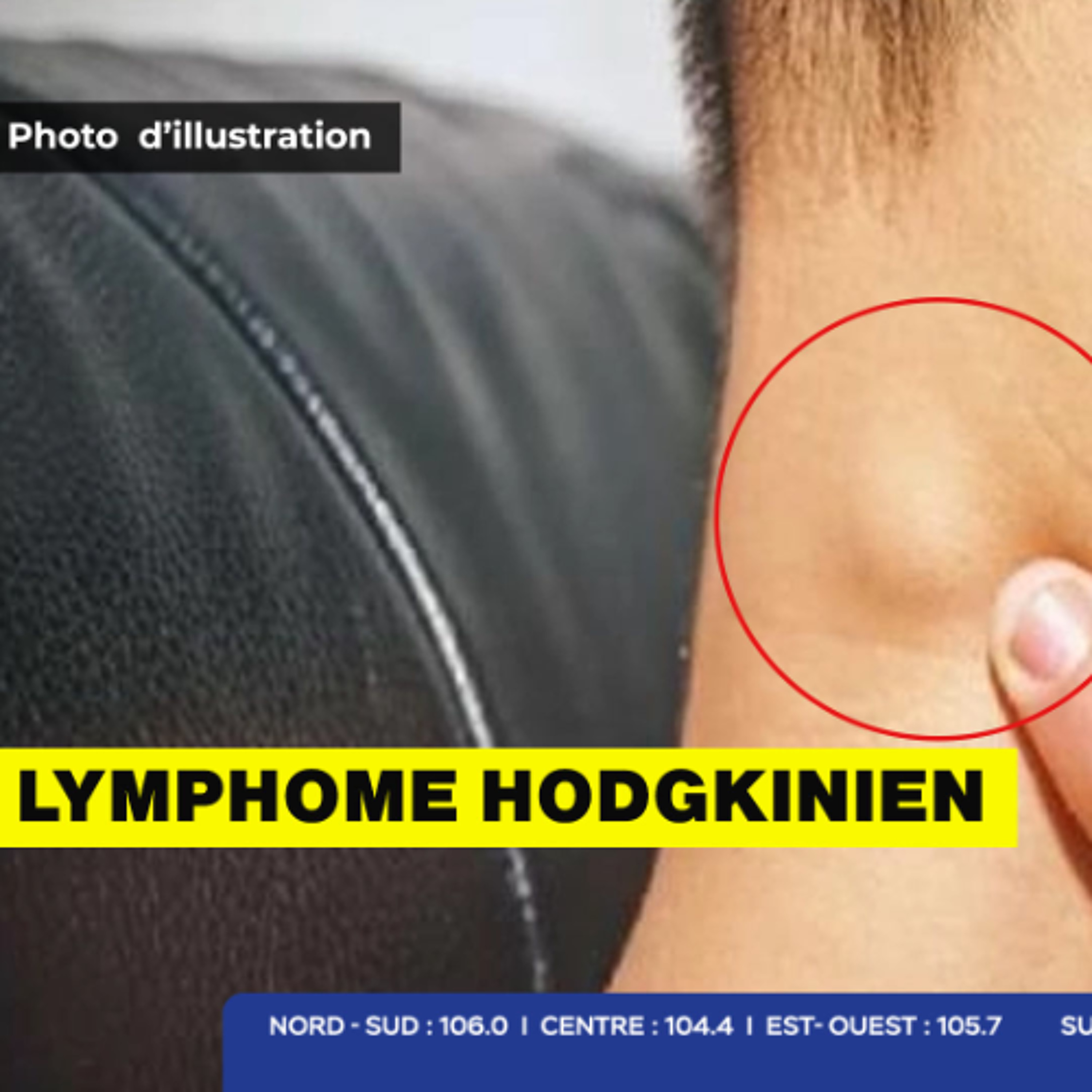 Un combat pour la vie : un policier de 34 ans fait face à un cancer et sa famille lance un appel à la solidarité