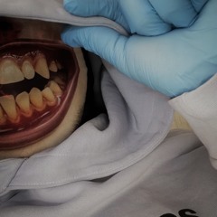 splatter gats (twovrt perc40)