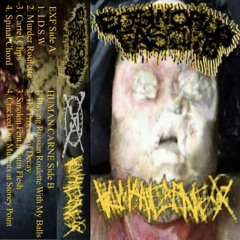 Eosinophilic Fasciitis // Human Carne Split