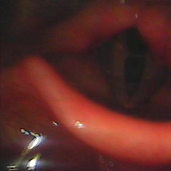 Retrabalho (Demo) - dadá Joãozinho