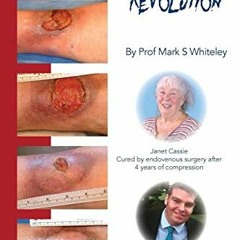 [View] PDF EBOOK EPUB KINDLE Leg Ulcer Treatment Revolution by  Mark S Whiteley 🖊️