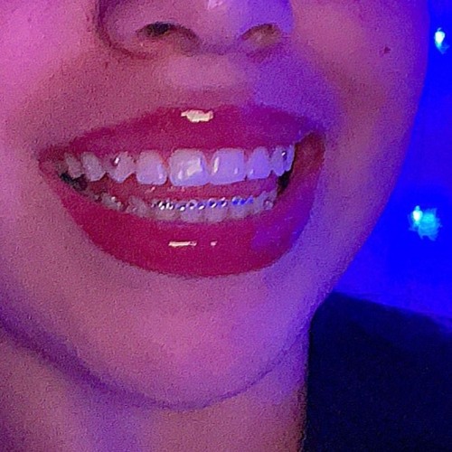 Pearly Whites Bundle 24+