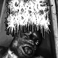 NECROTIZING FASCIITIS - SINGLE