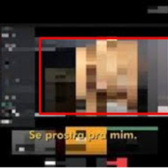 NEWS VIDEO menina engole lamina lamina 3 pontas portal zacarias lamina de 3 pontas