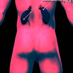 Kidney Stines