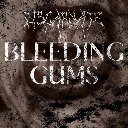Bleeding Gums
