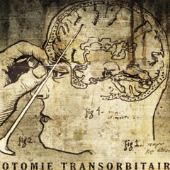 Lobotomix