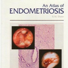 GET EPUB √ An Atlas of Endometriosis by  R. W. Shaw [KINDLE PDF EBOOK EPUB]