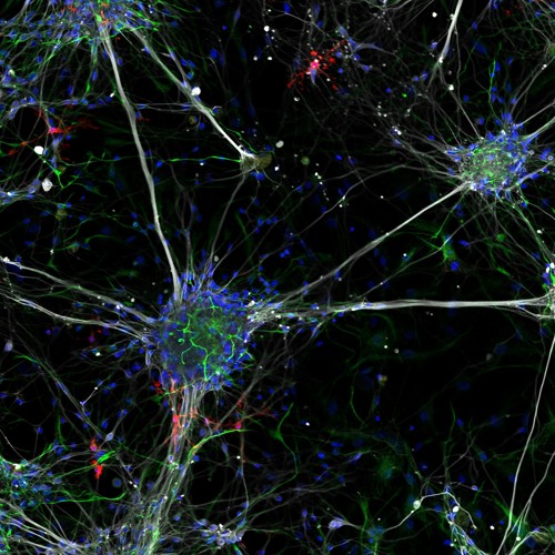 Psychedelic Techno & Zenonesque