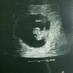 The Sequel [prod. Rasody3000 x YSP]