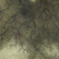 inner ; Outer w_ Sleep Exchange