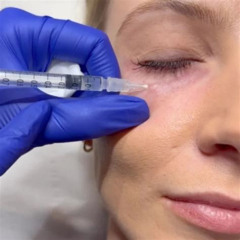 Best Under Eye Polynucleotide Treatment Reviews