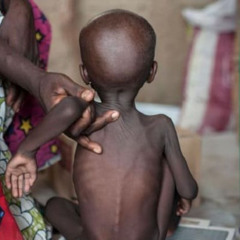 En RDC, l’insécurité et les conflits aggravent la crise nutritionnelle