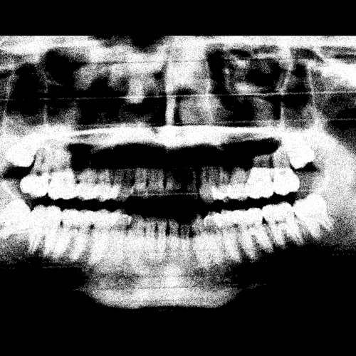Hollow Point w/Blood of Aza