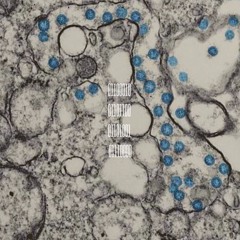 01001011