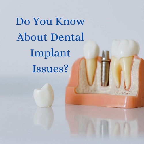 Do You Know About Dental Implant Issues