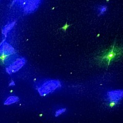 LuV GONE Feat. RIKAXBLINKXS (Prod. choki)