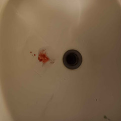 AN6EXX - Blood In The Sink
