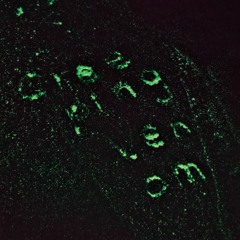 Kingbastard - Creeping Venom