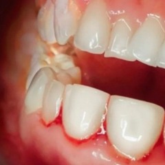 niery-K0pej me na zemi