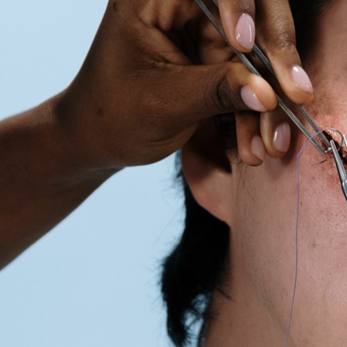 All My Riches Are Stitches - (2 - 14 - 2023 Skirmish)