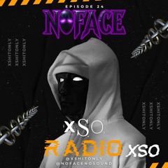 NOFACE - XSO RADIO MIX