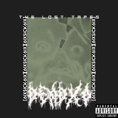 [MissingTape]