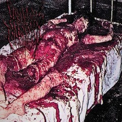 Stomped On And Dismembered