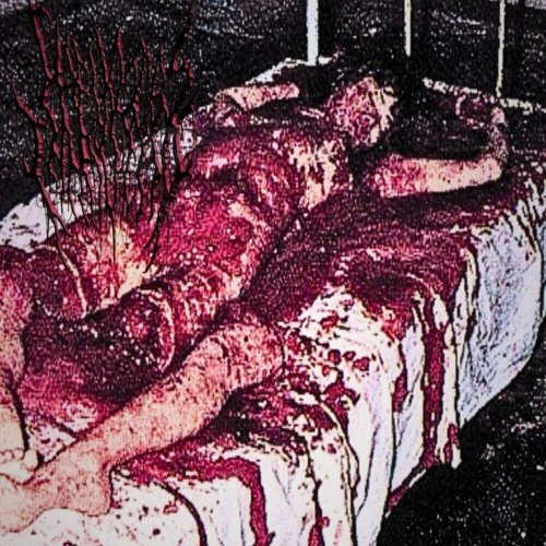 Stomped On And Dismembered