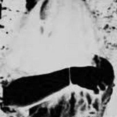 blackbeard [prod. chase euro$]