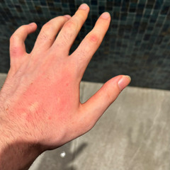 EVİMİ TAHTA KURUSU BASTI